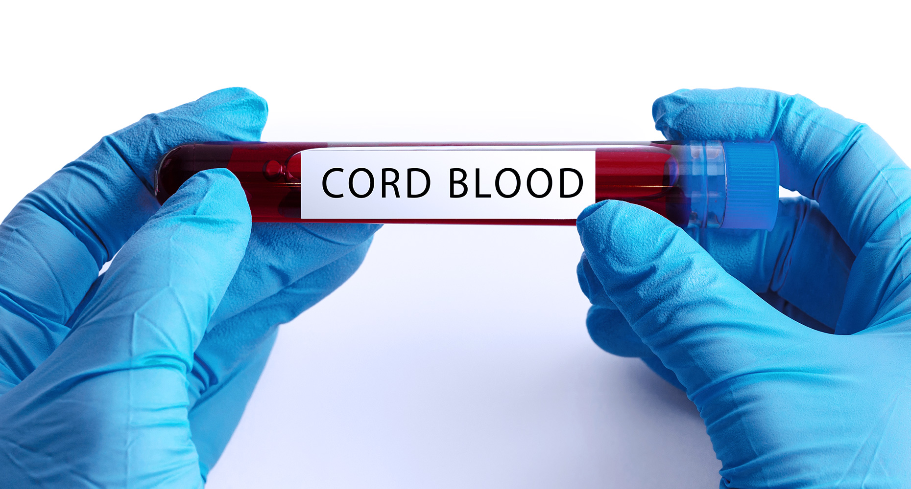 What You Need to Know About Cord Blood HemoCue America